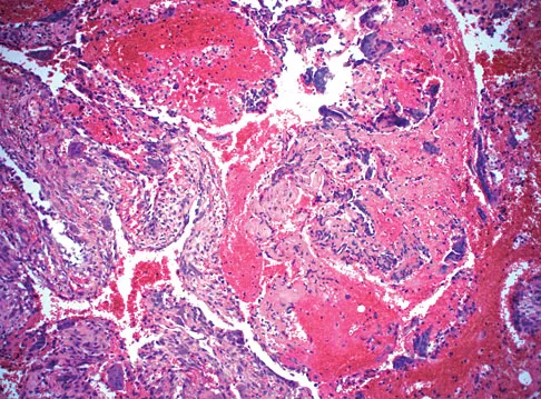 General Orthopedics Board Review 2026: High-Yield MCQs (Set 8) - Figure 81
