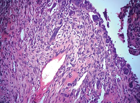 General Orthopedics Board Review 2026: High-Yield MCQs (Set 8) - Figure 82