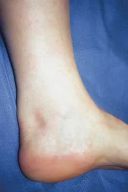 General Orthopedics 2026 Practice Questions: Set 9 (Solved) - Figure 10