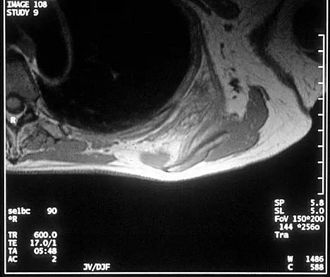 General Orthopedics 2026 Practice Questions: Set 9 (Solved) - Figure 11