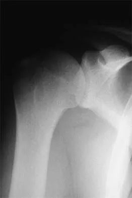 General Orthopedics 2026 Practice Questions: Set 9 (Solved) - Figure 13