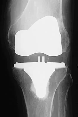 General Orthopedics 2026 Practice Questions: Set 9 (Solved) - Figure 16