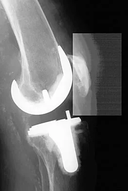 General Orthopedics 2026 Practice Questions: Set 9 (Solved) - Figure 17
