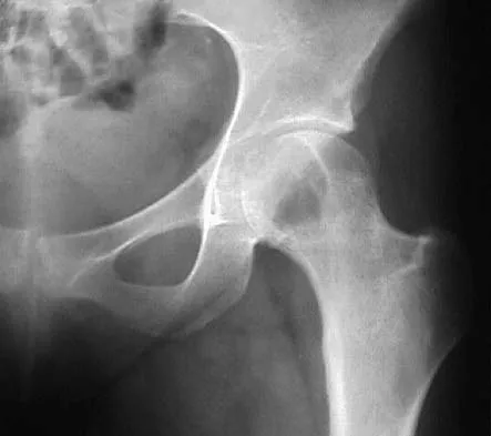 General Orthopedics 2026 Practice Questions: Set 9 (Solved) - Figure 19