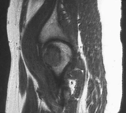 General Orthopedics 2026 Practice Questions: Set 9 (Solved) - Figure 20
