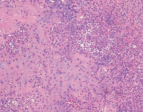 General Orthopedics 2026 Practice Questions: Set 9 (Solved) - Figure 22
