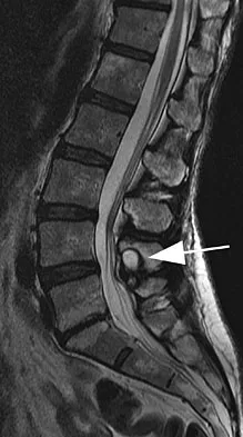 General Orthopedics 2026 Practice Questions: Set 9 (Solved) - Figure 25