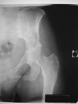 General Orthopedics 2026 Practice Questions: Set 9 (Solved) - Figure 28