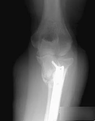 General Orthopedics 2026 Practice Questions: Set 9 (Solved) - Figure 32