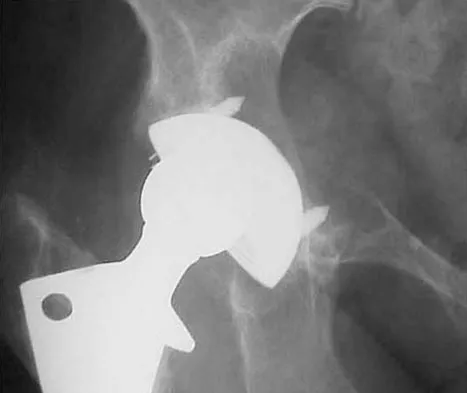 General Orthopedics 2026 Practice Questions: Set 9 (Solved) - Figure 39