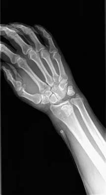 General Orthopedics 2026 Practice Questions: Set 9 (Solved) - Figure 40