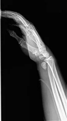 General Orthopedics 2026 Practice Questions: Set 9 (Solved) - Figure 41