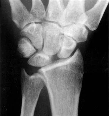 General Orthopedics 2026 Practice Questions: Set 9 (Solved) - Figure 48