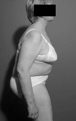 General Orthopedics 2026 Practice Questions: Set 9 (Solved) - Figure 49