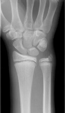 General Orthopedics 2026 Practice Questions: Set 9 (Solved) - Figure 5