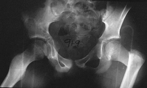 General Orthopedics 2026 Practice Questions: Set 9 (Solved) - Figure 53