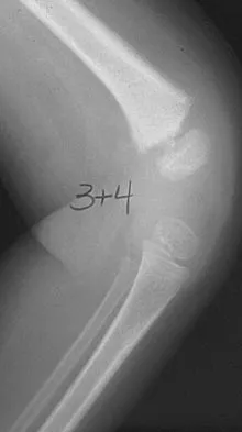 General Orthopedics 2026 Practice Questions: Set 9 (Solved) - Figure 54