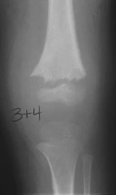 General Orthopedics 2026 Practice Questions: Set 9 (Solved) - Figure 55