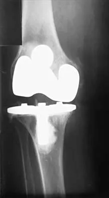 General Orthopedics 2026 Practice Questions: Set 9 (Solved) - Figure 56