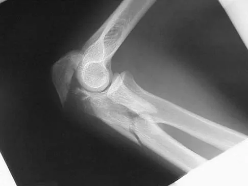 General Orthopedics 2026 Practice Questions: Set 9 (Solved) - Figure 59