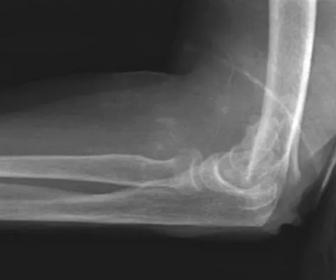 General Orthopedics 2026 Practice Questions: Set 9 (Solved) - Figure 70
