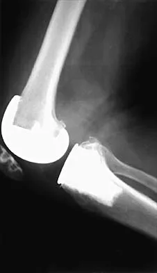 General Orthopedics 2026 Practice Questions: Set 9 (Solved) - Figure 72