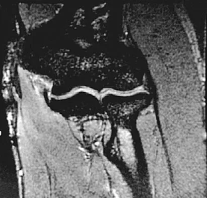 General Orthopedics 2026 Practice Questions: Set 9 (Solved) - Figure 75
