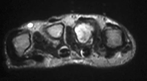General Orthopedics 2026 Practice Questions: Set 9 (Solved) - Figure 78