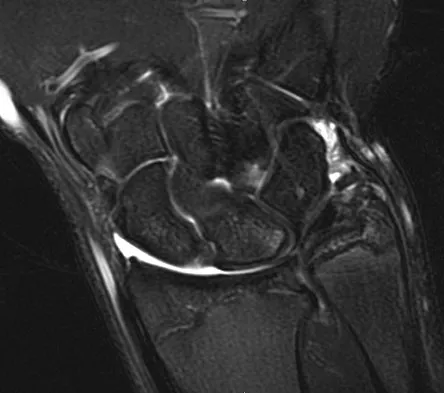 General Orthopedics 2026 Practice Questions: Set 9 (Solved) - Figure 8
