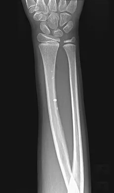 General Orthopedics 2026 Practice Questions: Set 9 (Solved) - Figure 80