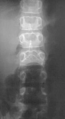 General Orthopedics 2026 Practice Questions: Set 9 (Solved) - Figure 81