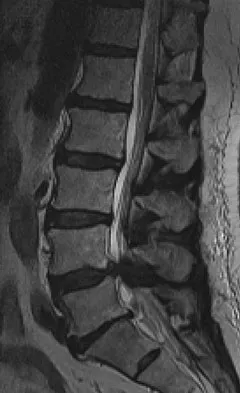 General Orthopedics 2026 Practice Questions: Set 9 (Solved) - Figure 86