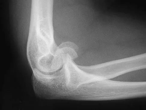 General Orthopedics 2026 Practice Questions: Set 9 (Solved) - Figure 89