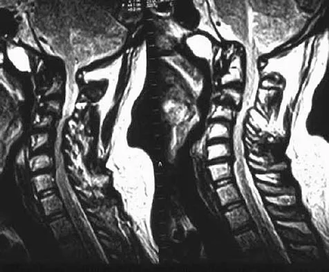 General Orthopedics 2026 Practice Questions: Set 9 (Solved) - Figure 95