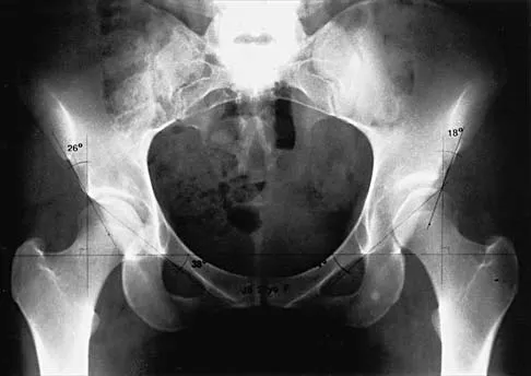 Hip 2001 Practice Questions: Set 1 (Solved) - Figure 10
