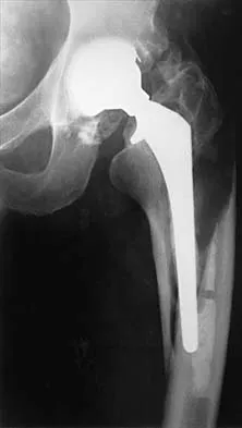 Hip 2001 Practice Questions: Set 3 (Solved) - Figure 3