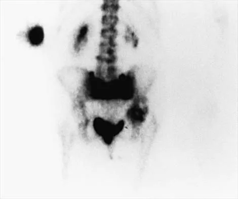 Hip Board Review 2001: High-Yield MCQs (Set 4) - Figure 10