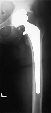 Hip Board Review 2001: High-Yield MCQs (Set 4) - Figure 14