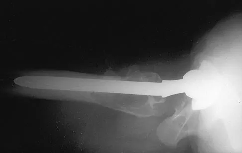 Hip 2004 Practice Questions: Set 1 (Solved) - Figure 9