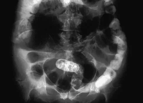 Hip 2004 Practice Questions: Set 3 (Solved) - Figure 2
