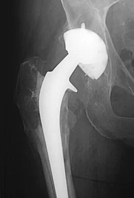 Hip 2004 Practice Questions: Set 3 (Solved) - Figure 5