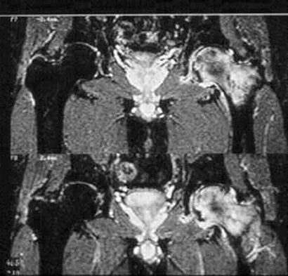Hip Board Review 2004: High-Yield MCQs (Set 4) - Figure 10