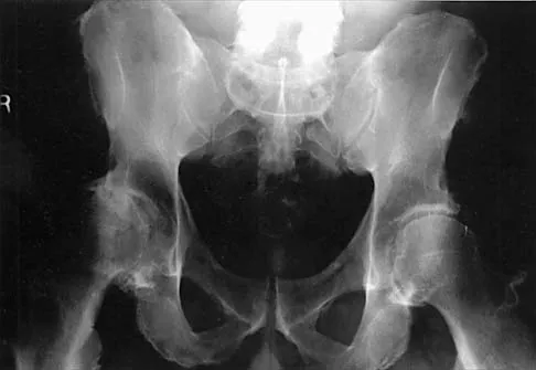 Hip 2026 MCQs: Board Review Questions & Answers (Part 1) - Figure 15