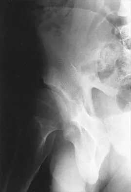 Hip 2026 MCQs: Board Review Questions & Answers (Part 1) - Figure 33