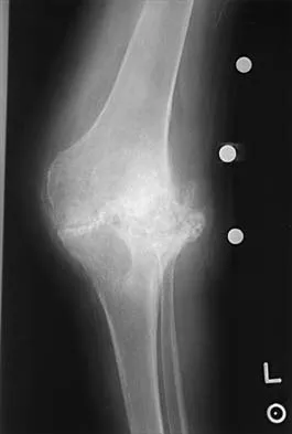 Hip 2026 MCQs: Board Review Questions & Answers (Part 1) - Figure 47