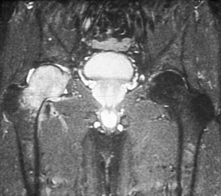 AAOS Orthopedic Hip MCQs (Part 2): Pathology, Trauma & Surgical Approaches | 2026 Board Review