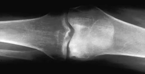 Hip 2026 MCQs: Board Review Questions & Answers (Part 2) - Figure 17