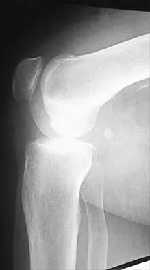 Hip 2026 MCQs: Board Review Questions & Answers (Part 2) - Figure 27