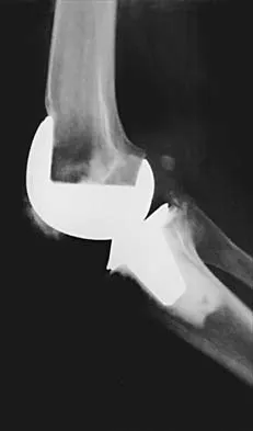 Hip 2026 MCQs: Board Review Questions & Answers (Part 3) - Figure 11