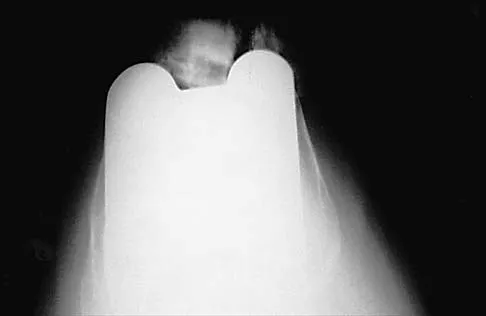 Hip 2026 MCQs: Board Review Questions & Answers (Part 3) - Figure 13